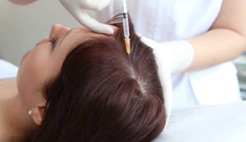 Плазмотерапия волосистой части головы сколько нужно процедур