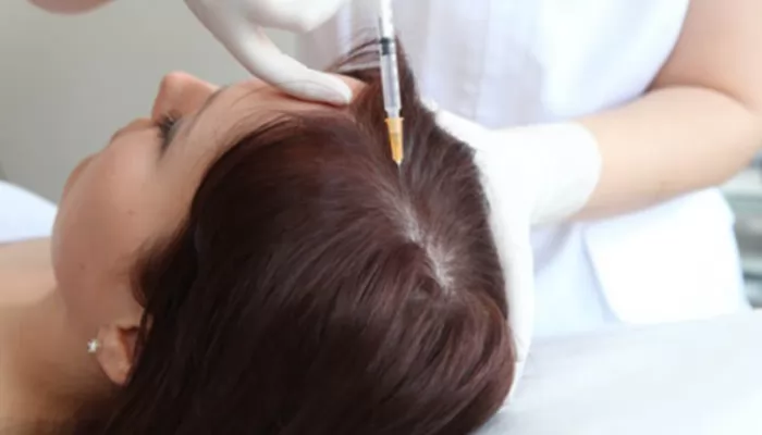 плазмотерапия волосистой части головы